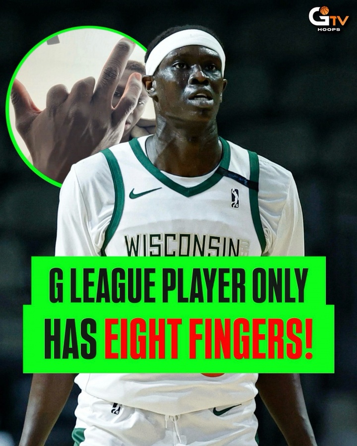 8個(gè)指頭也能打籃球！Yor Anei用8根手指打到了G聯(lián)盟！不可思議！